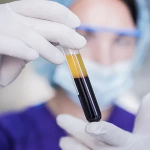 Imersão em PRF progressivo ozonizado