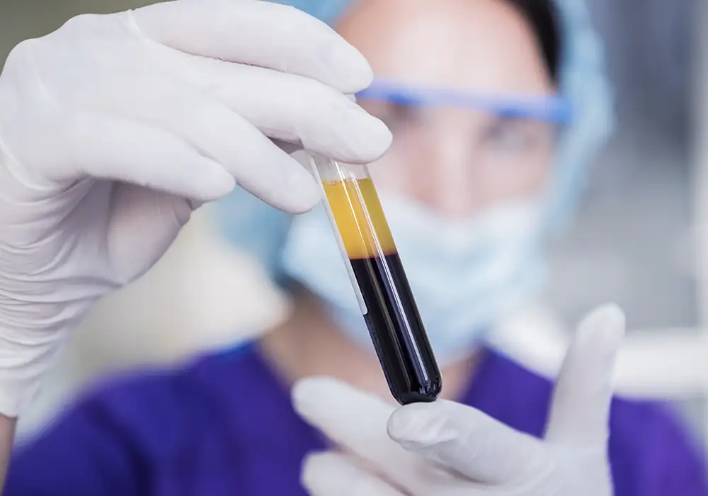 Imersão em PRF progressivo ozonizado